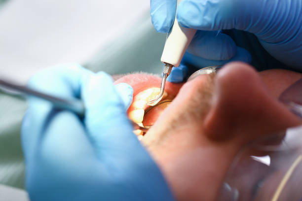 Best Cracked Tooth Emergency Dentist  in Georgetown, GA