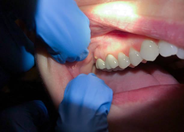 Best Broken Tooth Emergency  in Georgetown, GA