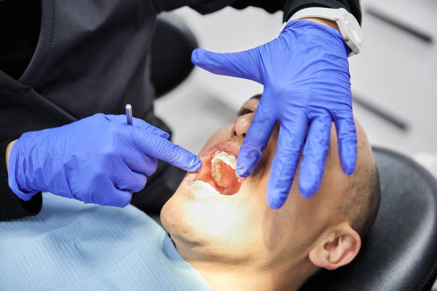 Best Teeth Whitening  in Georgetown, GA